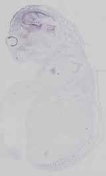 EMAGE:16743
