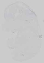EMAGE:16743