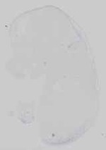 EMAGE:16743