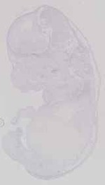 EMAGE:16757
