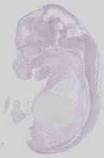 EMAGE:16759