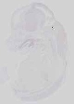 EMAGE:16769