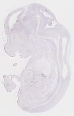 EMAGE:17118