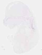 EMAGE:17366