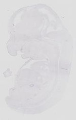 EMAGE:17459
