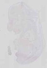 EMAGE:17474