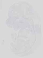 EMAGE:17484