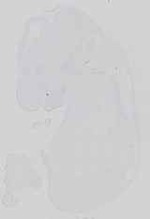 EMAGE:17652