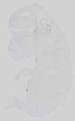 EMAGE:17652