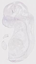 EMAGE:17729