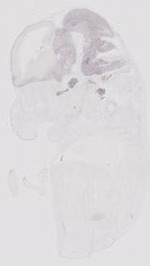 EMAGE:17807