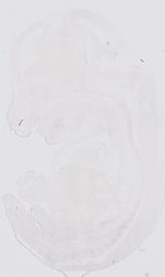 EMAGE:17820