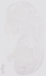EMAGE:17840