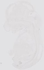EMAGE:17840