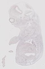 EMAGE:17858
