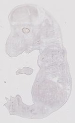 EMAGE:17858