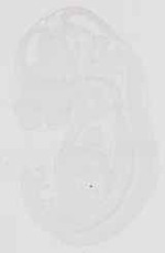 EMAGE:17888