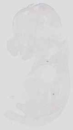 EMAGE:17902