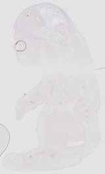 EMAGE:17910