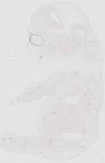 EMAGE:17910