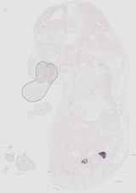 EMAGE:17910