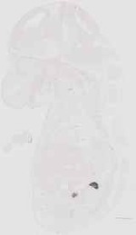 EMAGE:17910