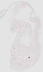 EMAGE:17910