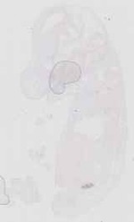 EMAGE:17910