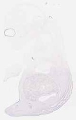 EMAGE:17928