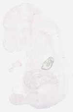 EMAGE:17928