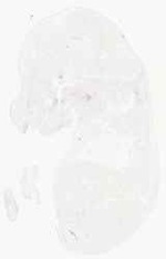 EMAGE:17930
