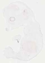 EMAGE:17945