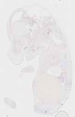 EMAGE:17953