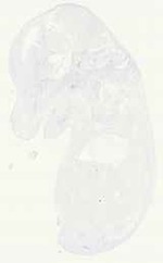 EMAGE:17977