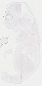 EMAGE:17986