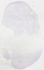 EMAGE:18006
