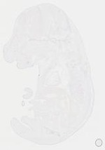 EMAGE:18006
