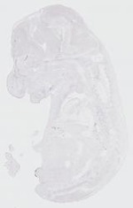 EMAGE:18008