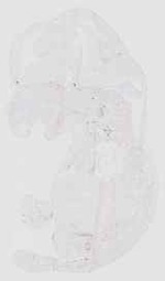 EMAGE:18085