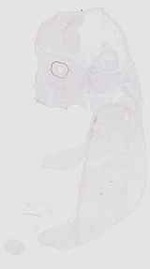 EMAGE:18086