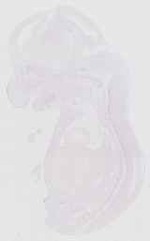 EMAGE:18241