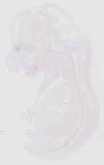 EMAGE:18241