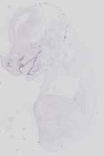 EMAGE:18386