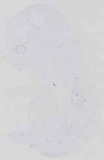 EMAGE:18389