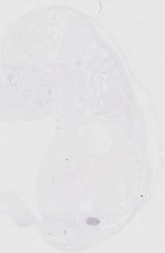 EMAGE:18424