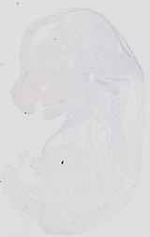 EMAGE:18456