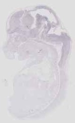 EMAGE:18458