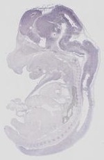 EMAGE:18458