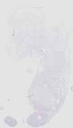 EMAGE:18511