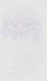 EMAGE:18514
